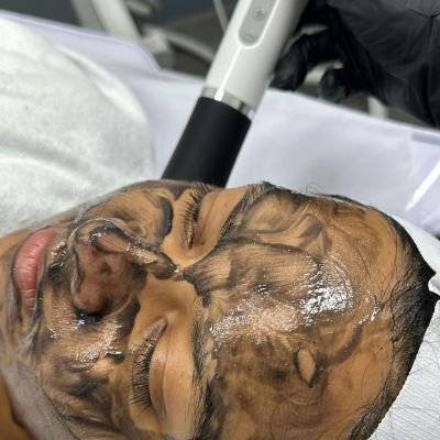Person receiving a deep cleansing facial with a black mask applied.