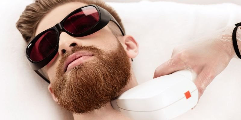 laser hair removal men face