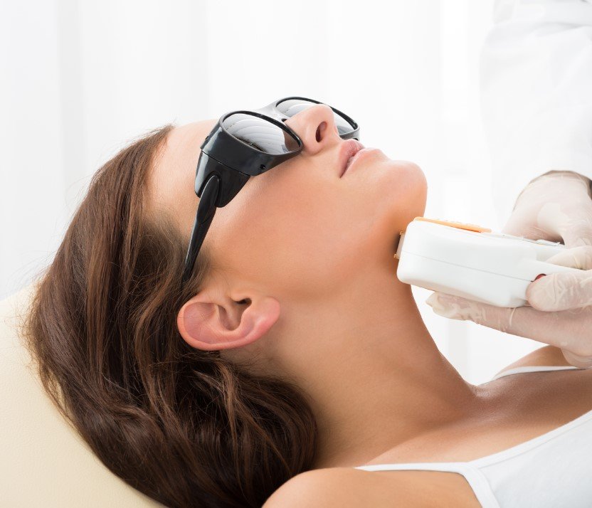 Neck Laser Hair Removal