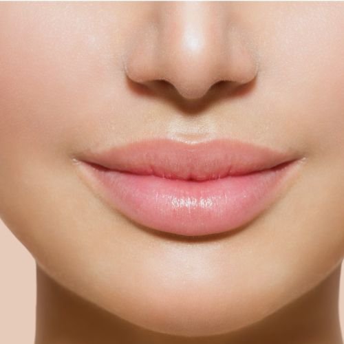 Lip Fillers