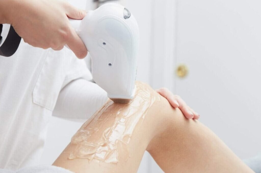 laser hair removal north york