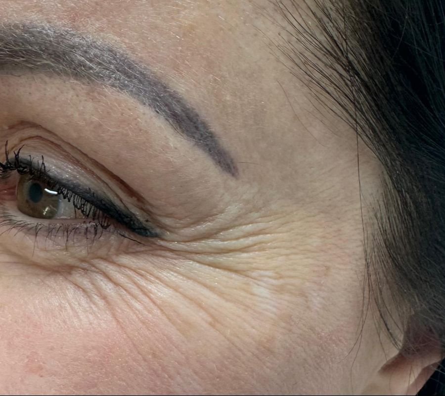 certified botox provider north york