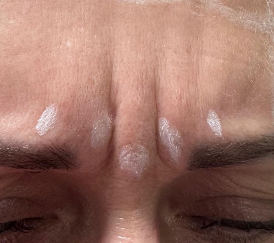 cosmetic clinic north york