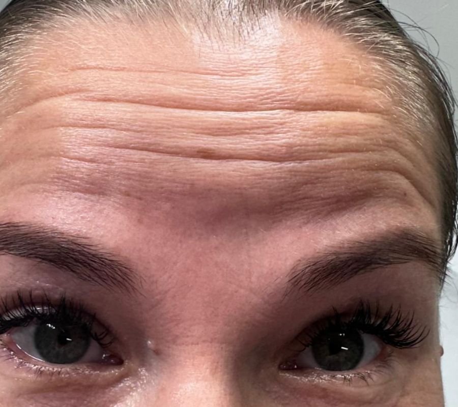 facial treatments north york